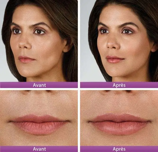 is melanotan 2 safe reddit You Should Avoid Using Nasal Tanning Sprays