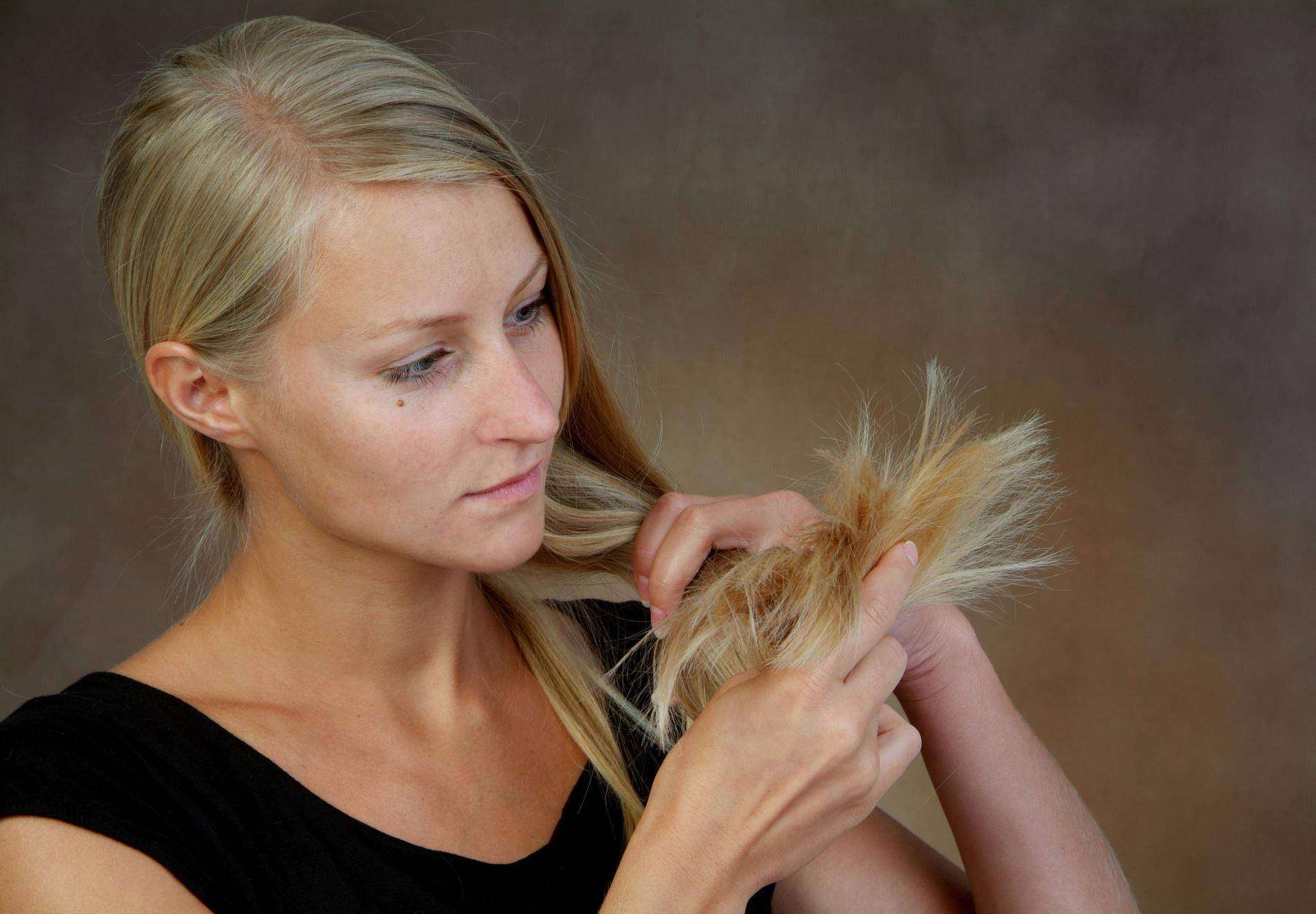 alopecie