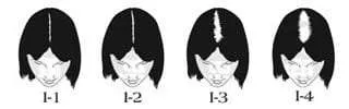 Ludwig scale  Types of hair loss – Neofollics